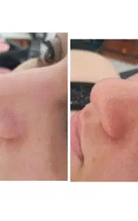 ۵۰٪ تخفیف خدمات فیشیال به مناسبت جابه جایی سالن