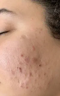نتیجه کرم تخصصی