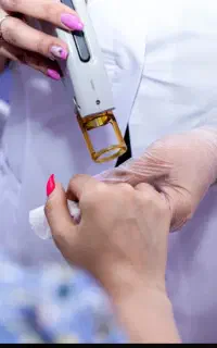 استخدام اپراتور لیزر موهای زائد دستگاه الکس نابلکس