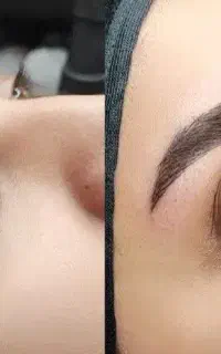 آموزش و خدمات میکروبلیدینگ فیبروز