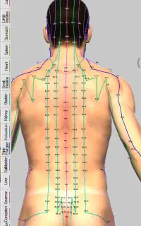 فیزیوتراپی در منزل،طب سوزنی ،لیزر پرتوان  در منزل