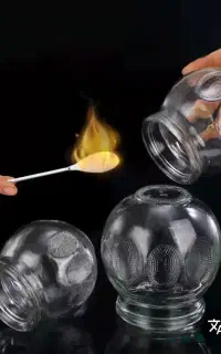 حجامت بادکش زالودرمانی کهنوج