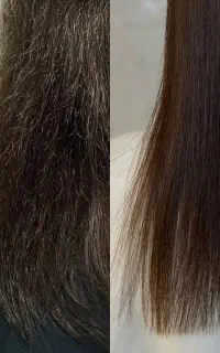 تخفیف موخوره گیری