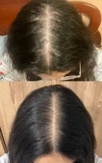 موهات طبیعی در بیار