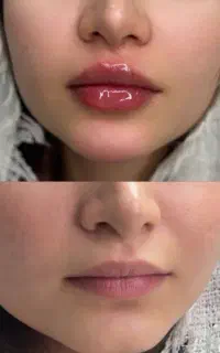 انتخاب متفاوت برای زیبایی و جوانی در اردبیل