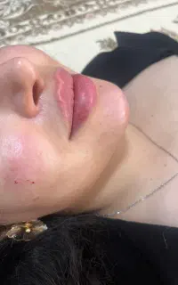 چانه لب سیب گونه خط خنده خط اخم