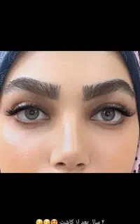 کاشت ابرو تخصصی