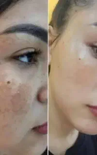 کرم ترمیم کننده بیوممتیک