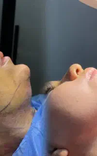 ساکشن در مطب پزشک