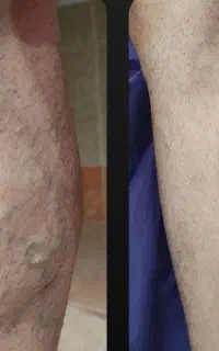 ‌کلینیک تخصصی درمان واریس
