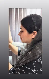 لابیاپلاستی فقط ۸/۴۰۰ تا ۲۵ مرداد