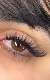 کاشت هیدن توسط استاد انجام میشود