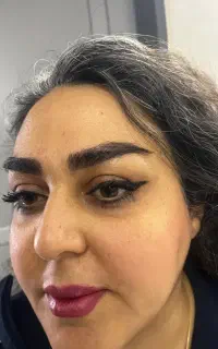 میکروکاشت اصفهان