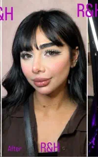 فیلربادی اقساط هیپدیپ باسن/کاشت ابروموژل/کانتورینگ