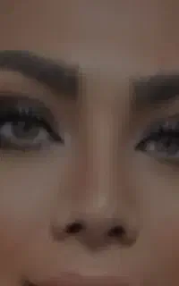 فرصتی استثنایی برای تجربه بوتاکس با کمترین هزینه