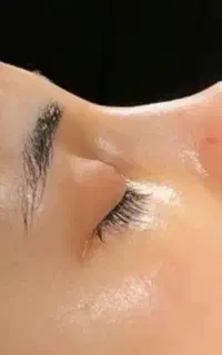 عمل جراحی زیبایی بینی،پلک،لیفت صورت،اندام