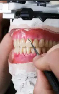 نیرو برای لابراتوار دندانسازی