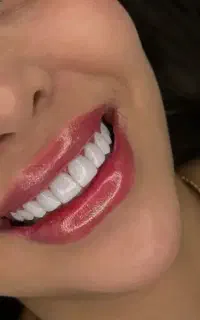 جشنواره تخفیفی تکرار نشدنی کامپوزیت