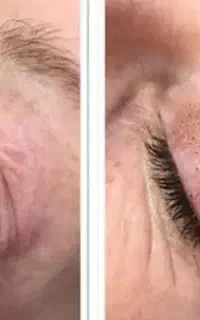 خدمات تخصصی زیبایی و جوانسازی پوست