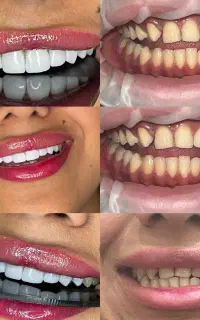 کلیه خدمات دندان پزشکی