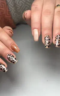 کاشت ناخن