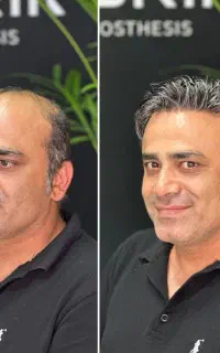 کلینیک تخصصی پروتزمو سبزوار