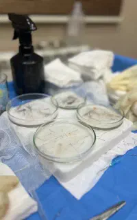 کاشت ابرو
