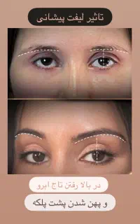 ادیتور حوزه اینستاگرام