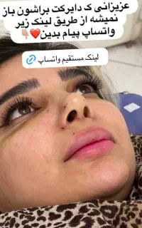 آف عمل بینی فقط ۲۲ تا آخر هفته