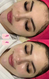 جشنواره فیشیال