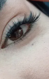 کاشت مژه