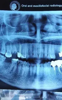 آموزش دندانسازی و دندانپزشکی