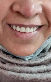 ساخت انواعدندان مصنوعی با عالی ترین کیفیت