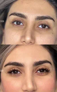 اکستنشن مژه و لیفت مژه و ابرو