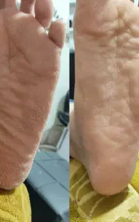 پدیکور و ژلیش
