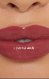 تزریق ژل بوتاکس چربی