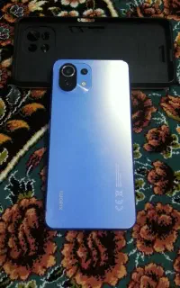 شیاومیmi11 لایت