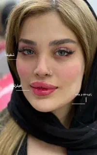 آف 50 درصدی تزریق ژل و بوتاکس در مطب پزشک