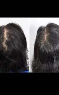 موهات چقد پرپشت شده