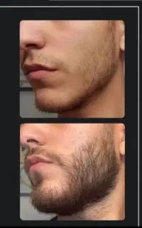معجزه ریش و سبیل