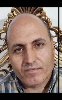کاشت مو و ابرو