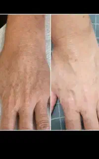 با مشکلات پوستی خداحافظی کن فقط با محصولات ایسل