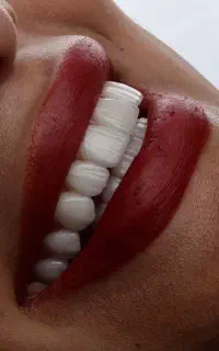 شرایط پرداختی آسان دندانپزشکی،زیبایی،ایمپلنت