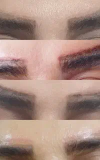 تضمینی تتوقدیمی ابروهاتوپاککن بایک جلسه ۷۰درصد۳۸۵۰