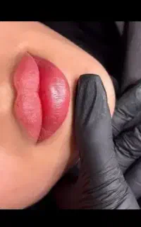 تزریق ژل و فیلر و بوتاکس
