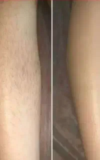 اپیلاسیون تخصصی اکسیر اموزش حرفه ای با ۱۵سال سابقه
