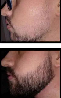 یک بار برای همیشه ریش دار شو