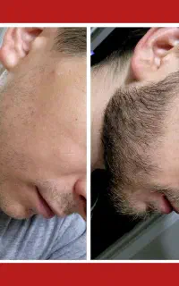 پرپشتی رو با ما تجربه کن
