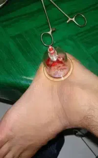 حجامت در منزل انجام میدم خانم و اقا