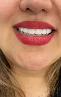 درمانگاه شبانه روزی تخفیف ویژه کامپوزیت،عصب کشی